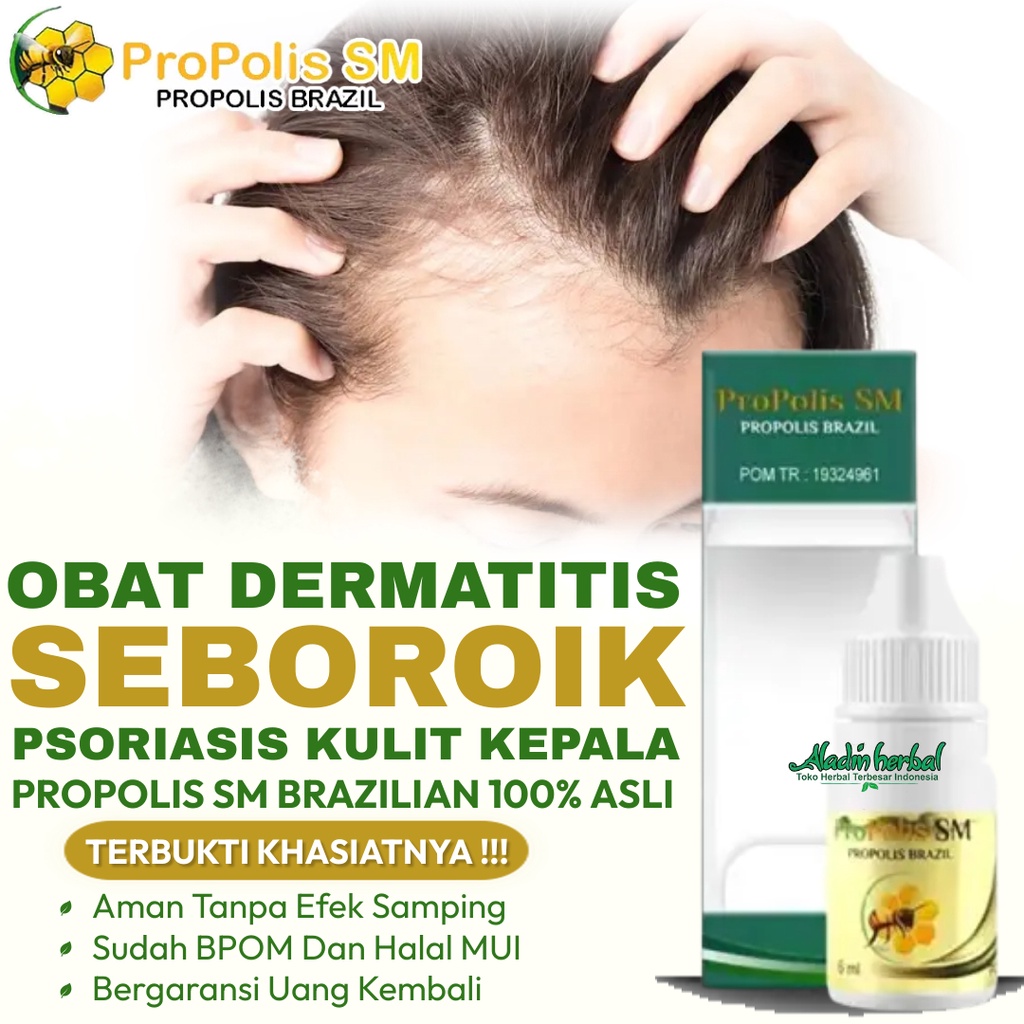 Jual PROPOLIS SM ORIGINAL Obat Dermatitis Seboroik Di Apotik Obat