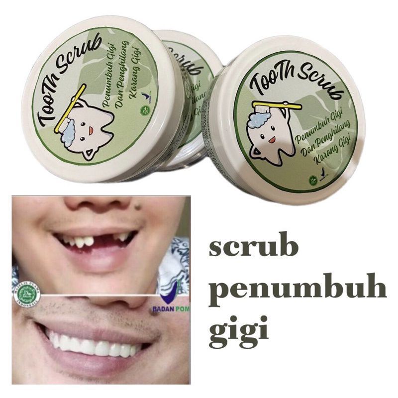 PENUMBUH GIGI ALAMI - GIGI OMPONH TERTAMBAL LAGI // GIGI PATAH RAPIH & BERSIH //