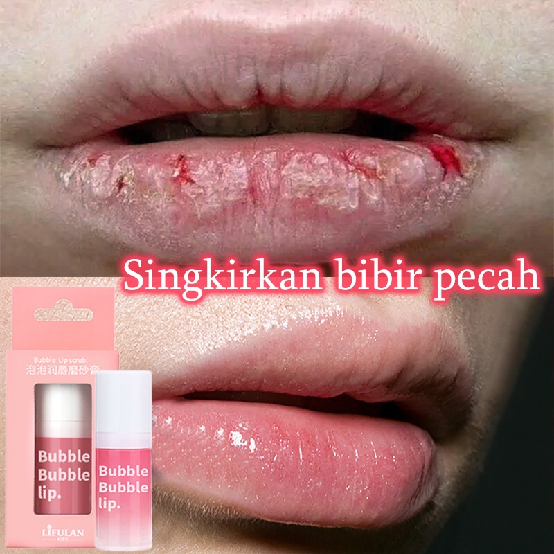 Perawatan bibir hitam dan kering Serum bibir untuk bibir hitam Lip balm Lip scrub 12g Bubble Scrub melembabkan dan melembabkan perawatan bibir pengelupasan kulit, mencerahkan garis bibir dan mencerahkan warna bibir Singkirkan bibir kering dan pecah