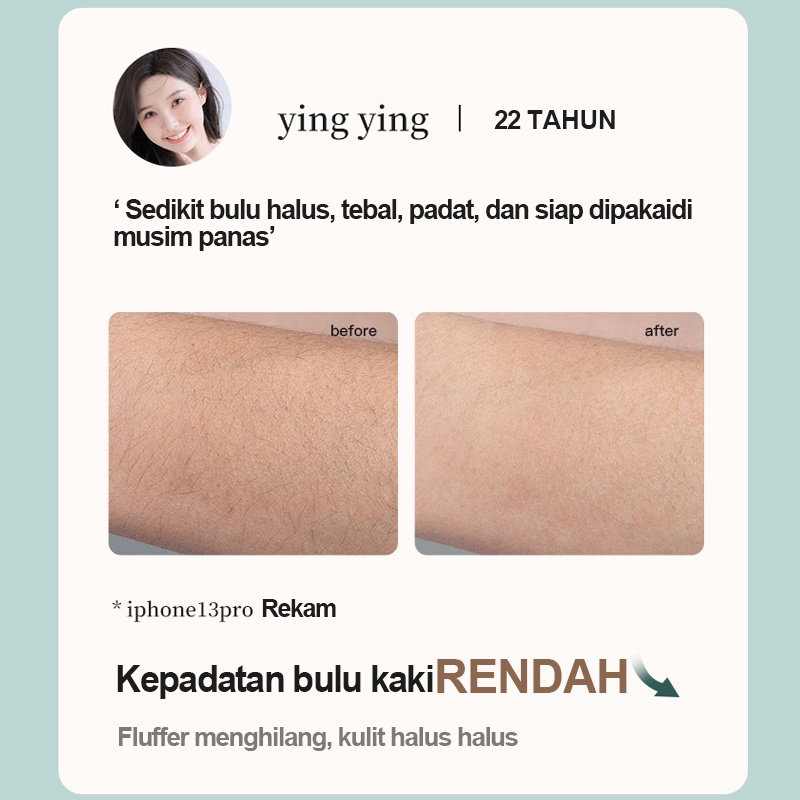 IPL laser Hair Removal Perontok Bulu Permanent / Alat Penghilang bulu TANPA SAKIT / Instrumen Penghilang Rambut / Laser Tubuh Es Tanpa Rasa Sakit