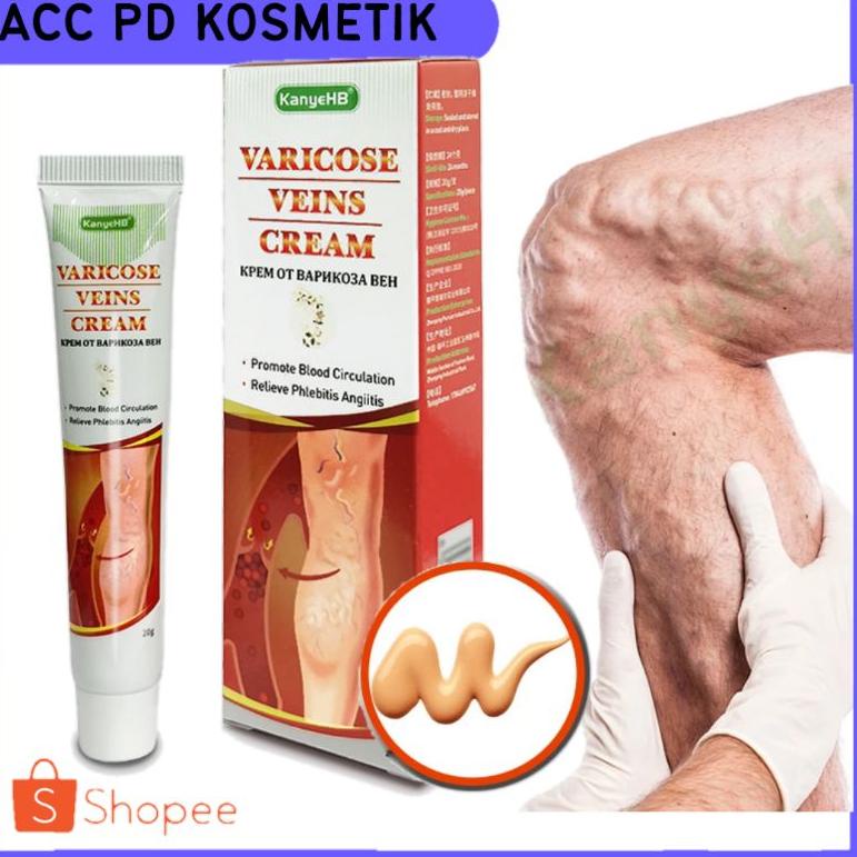 10.10 FLASH SALE SALEP VARISES AMPUH VARISES KAKI VARISES BETIS SALEP VARISES KEMALUAN SALEP VARIKOK
