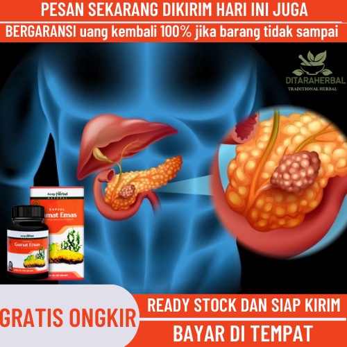 Obat pankreatitis, Obat Radang Pankreas, Obat Pankreatitis Akut, Obat Pankreatitis Kronis, Obat Nyer