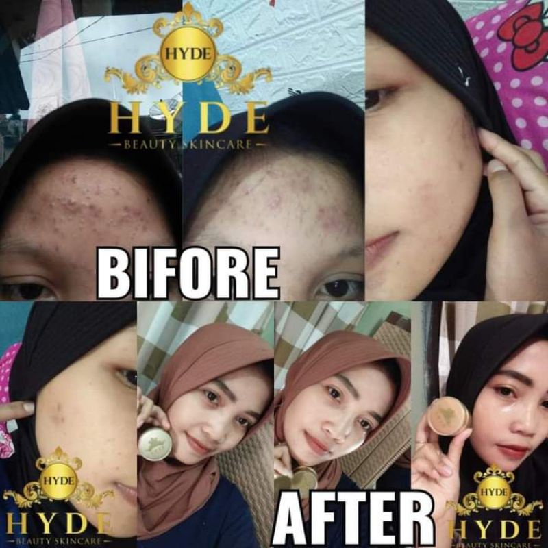 HYDE SKINCARE ORIGINAL FREE POUCH