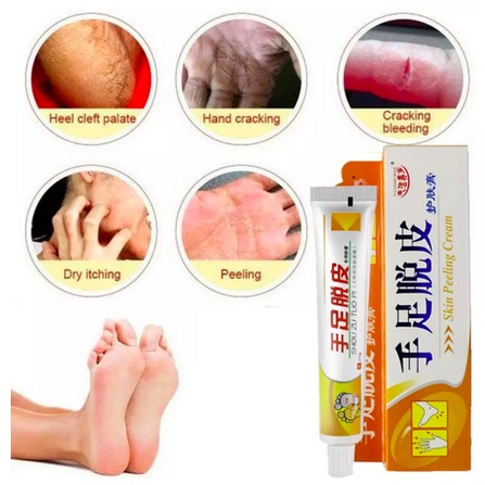 SALEP KAKI PECAH KAPALAN KERING OBAT TUMIT KASAR PECAH PECAH