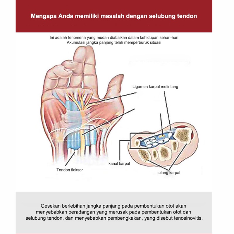 Obat Asam urat Rematik Radang Sendi Herbal Ampuh  Obat Saraf Kejepit Nyeri Sendi Nyeri Otot Asam Urat Rematik Kebas Kesemutan Sakit Kaki Sakit Paha Sakit Lutut Sakit Pinggang Sakit Leher Kaku Pegal Linu Pengoroposan Tulang Osteoporosit Obat Herbal Bersert