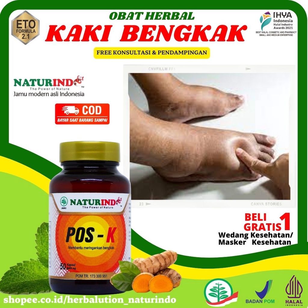 Obat Kaki Bengkak Karena Jatuh Kesleo Jantung Ginjal Obat Kaki Bengkak Karena Diabetes Pos K  Naturi