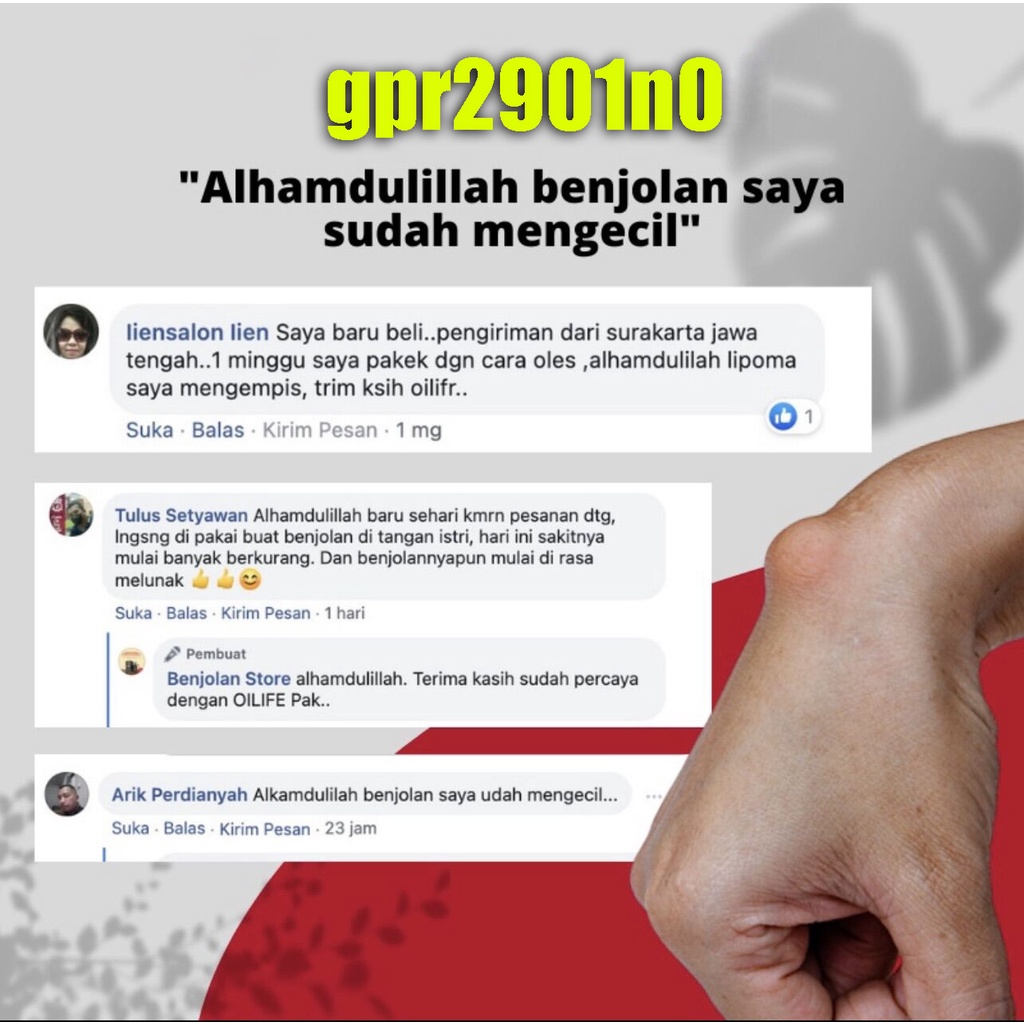 Obat Benjolan Lipoma Obat herbal Cina Krim lipoma 30g Perawatan punggung/leher/paha Kanker Tumor Kelenjar Tiroid Lipoma