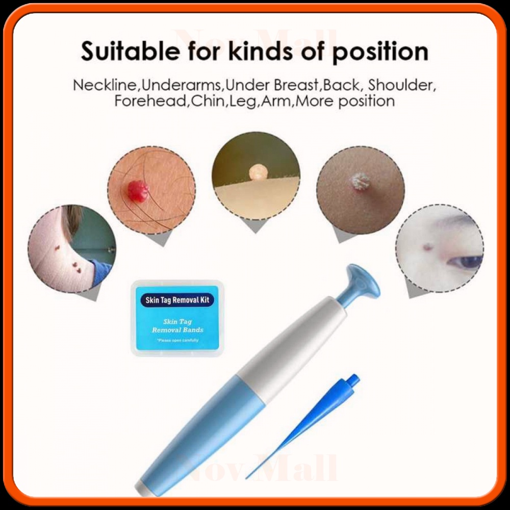 Alat Penghilang Kutil Painless Skin Tag Mole Removal Kit -BY006