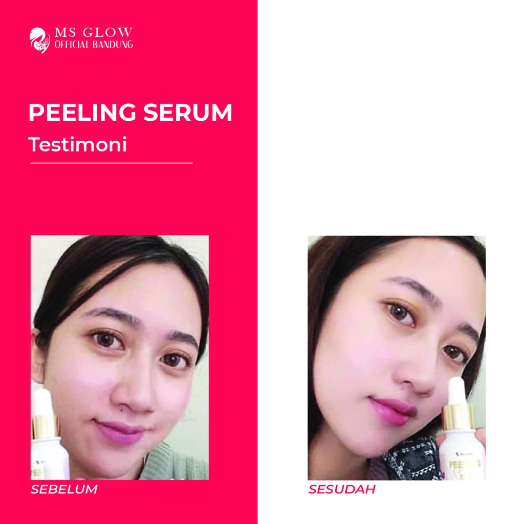 Peeling Serum MS Glow / Pencerah &amp; Pelembab Wajah Berkualitas Termurah - By Msglowofficialbandung