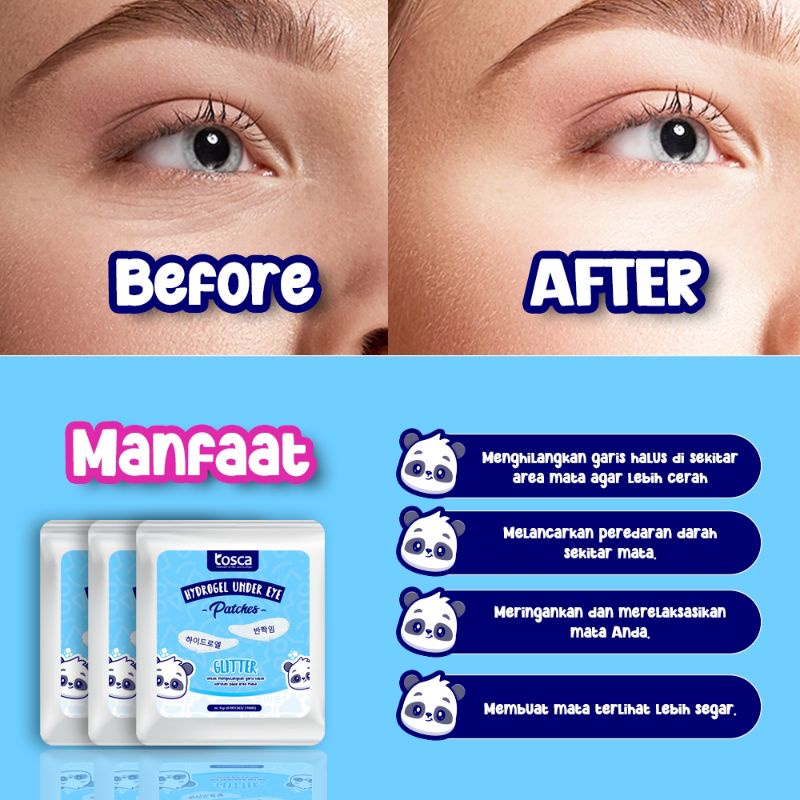 HYDROGEL UNDER EYE PATCHES PENGHILANG KANTUNG MATA &amp; KERUTAN MATA