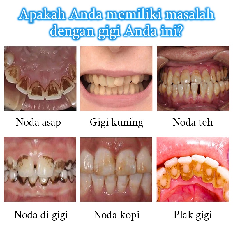 Perawatan Mulut Toothpaste Pemutih gigi Pasta gig Teeth whitening Cairan gigi putih 30ml Menghilangkan noda teh Gigi kuning Plak Napas jernih melindungi gusi Jaga kebersihan mulut