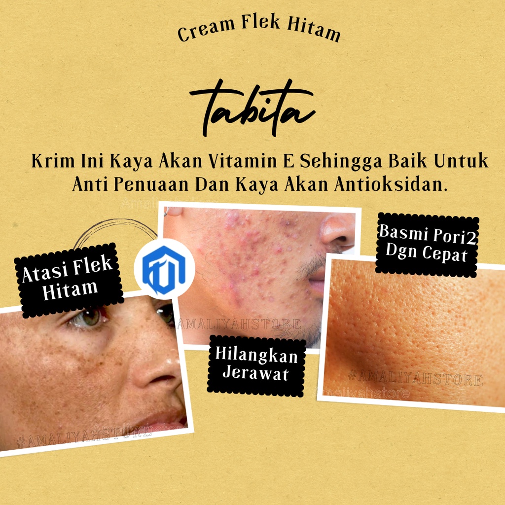 Tabitha Glow Krim Muka Glowing Obat Jerawat Dan Bekasnya Salep Whitening Buat Pria Dan Wanita Penghilang Flek Hitam Di Wajah Ampuh Bpom