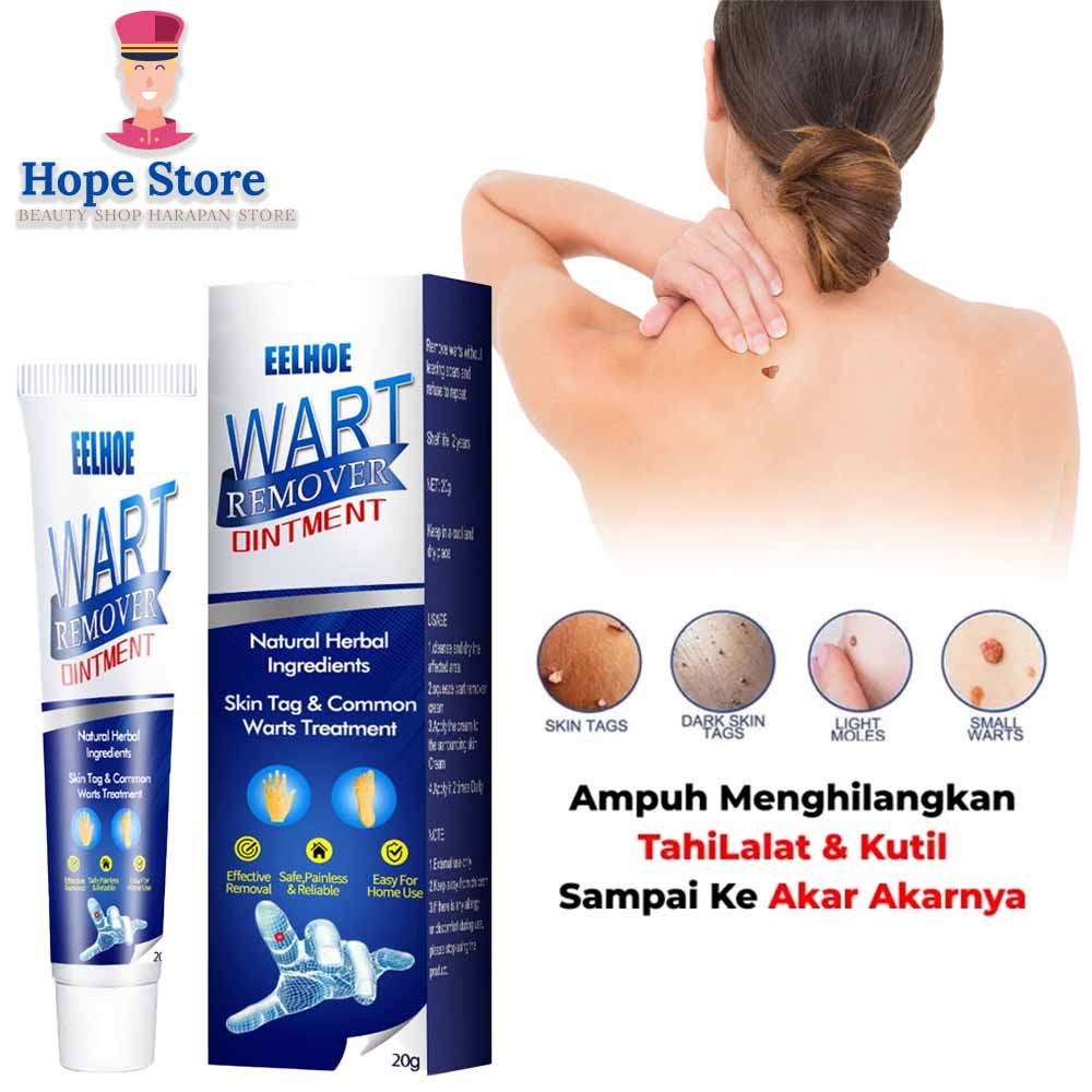 Hope Store  - Sumifun EELHOE Wart Remover Salep Obat Penghilang Tahi Lalat Dan Kulit