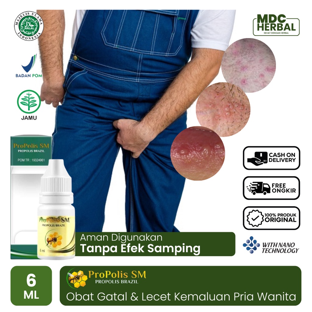 Obat Gatal dan Lecet Kemaluan, Bentol Bintik Merah Gatal dan Perih, Obat Gatal di Alat Kelamin Pria 