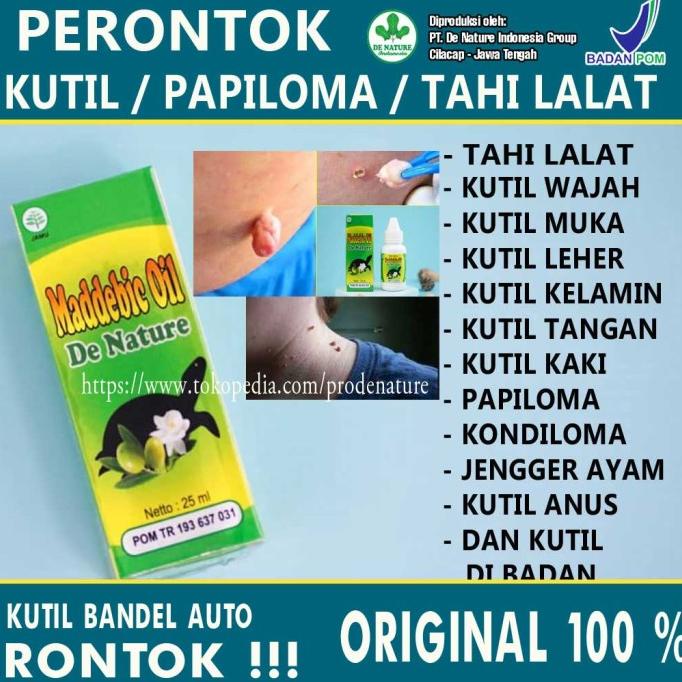 Kutil Rontok|Salep Kutil 100% Asli|Obat Perontok Kutil Ampuh