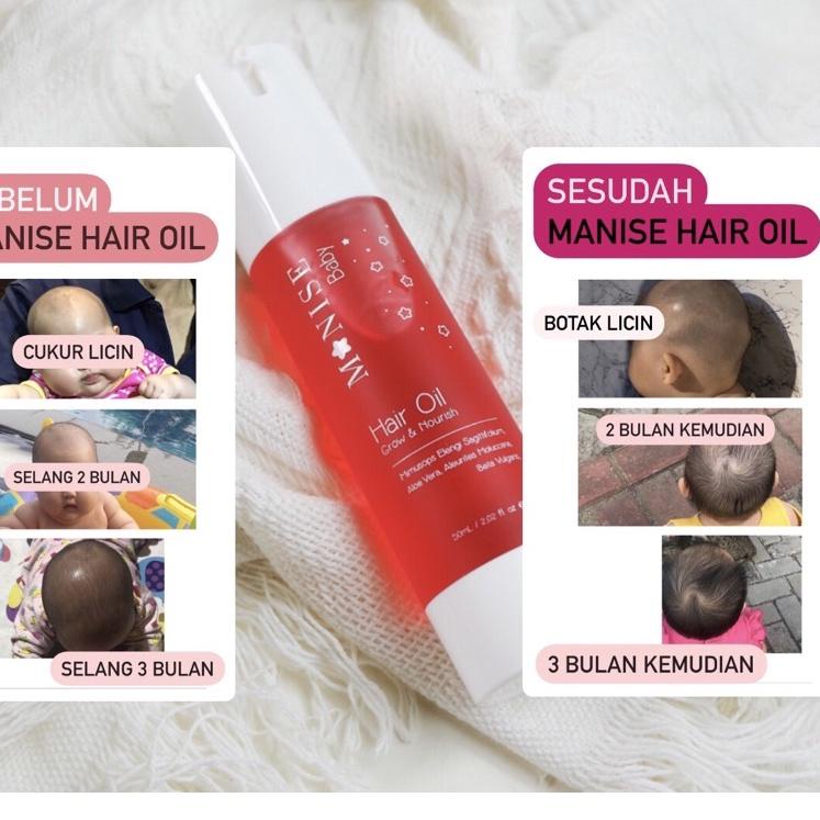 >XC26619<  GONDRONG HANYA 1 MINGGU  Manise Hair Oil baby minyak rambut kemiri lotion candle nut foll