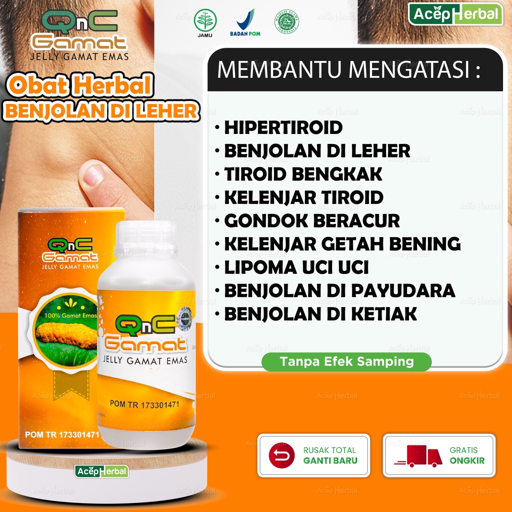 Jual Herbal Obat Benjolan Di Leher Kelenjar Getah Bening Tiroid Gondok ...