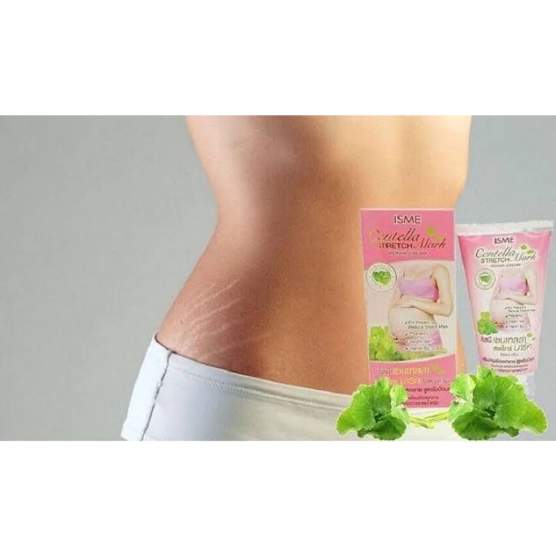 ISME Centella Stretch Mark Repair Cream Penghilang StretchMark Original