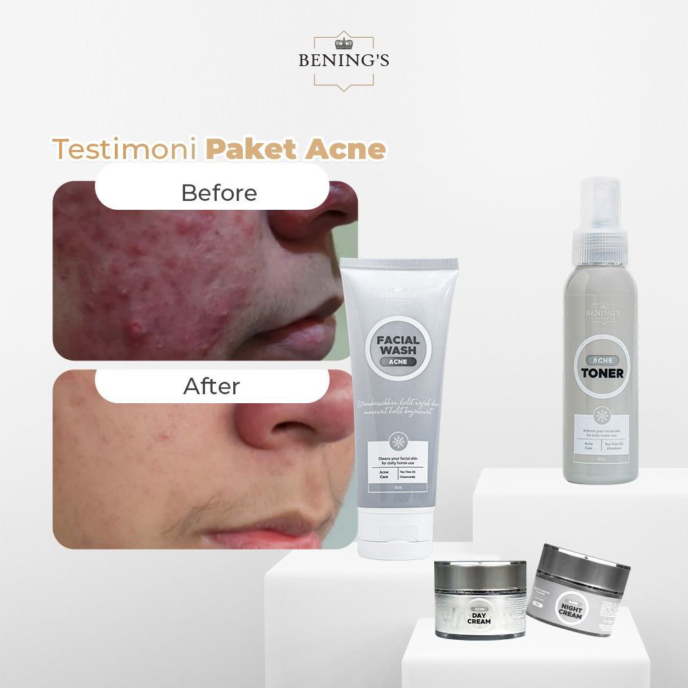 Paket Acne Bening Skincare Doctor Oky Pratama Benings Clinic