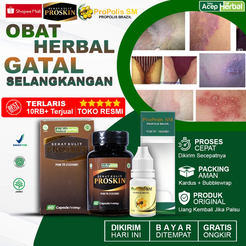 Jual Obat Gatal Selangkangan Babak Kulit Berjamur Bersisik Selangkangan Hitam Gatal Bintik 9030