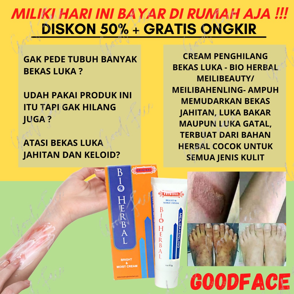 PENGHILANG BEKAS LUKA MEILIBAHENLING SALEP KORENG DAN BEKAS BIO HERBAL