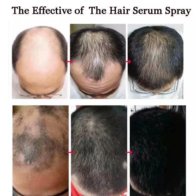 Serum penumbuh rambut jahe nutrisi semprot anti rambut rontok 30ml spray jahe nutrisi semprot jahe akar rambut semprot pelembab rambut.