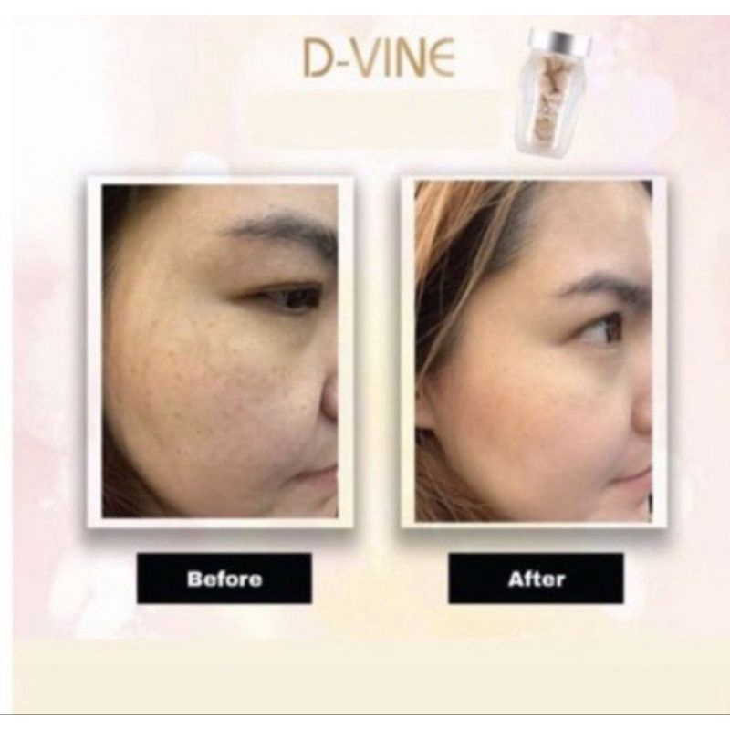 

D-Vine collagen suplemen