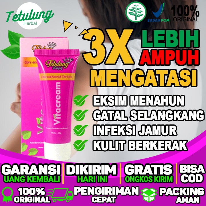 Obat Oles Vitacream Obat Gatal Gatal pada selangkangan dan selangkangan hitam