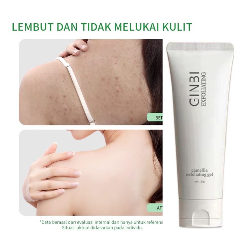 PEELING GEL PENGANGKAT SEL KULIT MATI GEL EXFOLIASI KULIT