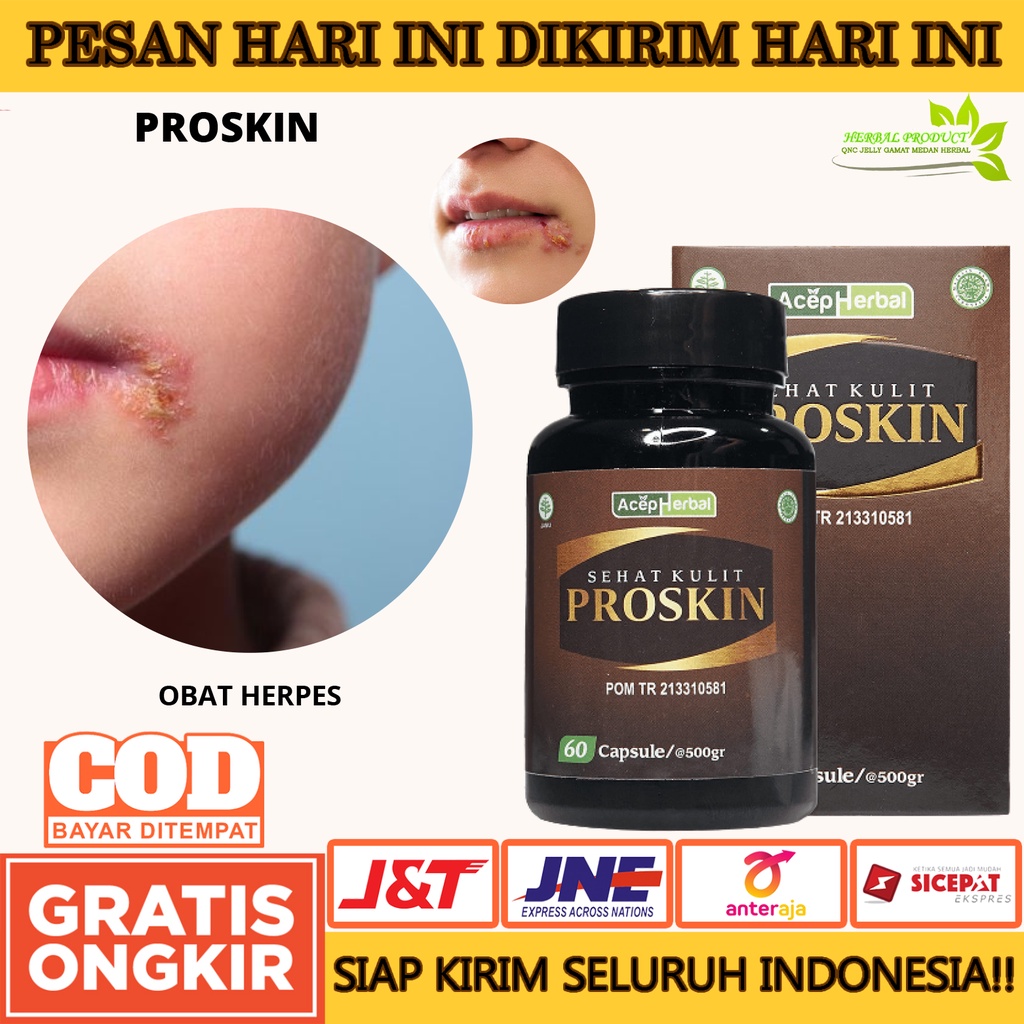 Jual Obat Herpes Kulit Herpes Genital Herpes Kelamin Gatal Kulit Gatal Menahun Eksim Campak