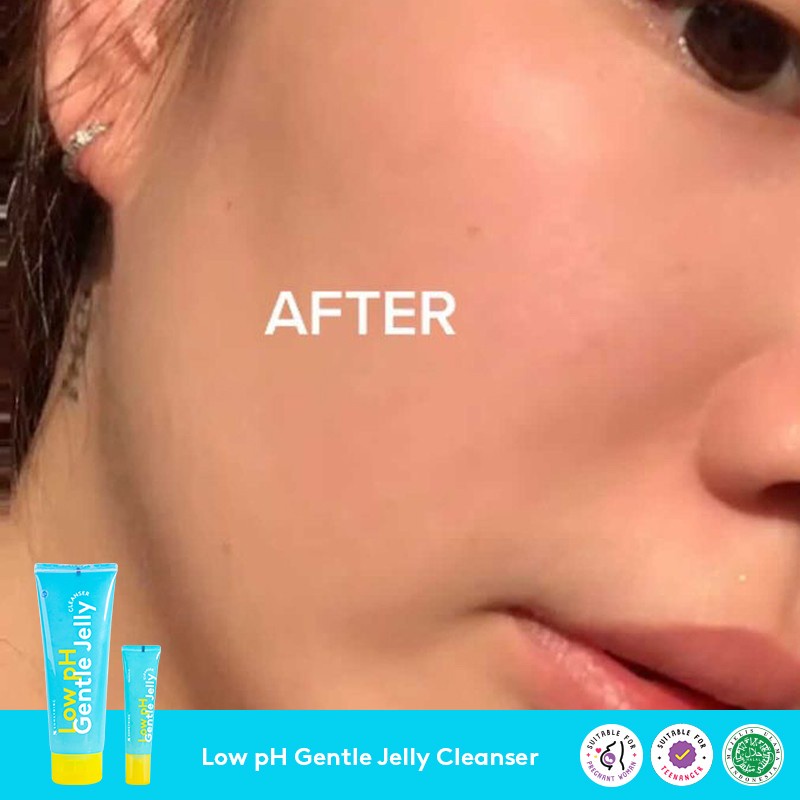 [NEW] SOMETHINC Low pH Gentle Jelly Cleanser - Sabun Cuci Muka Semua Jenis Kulit