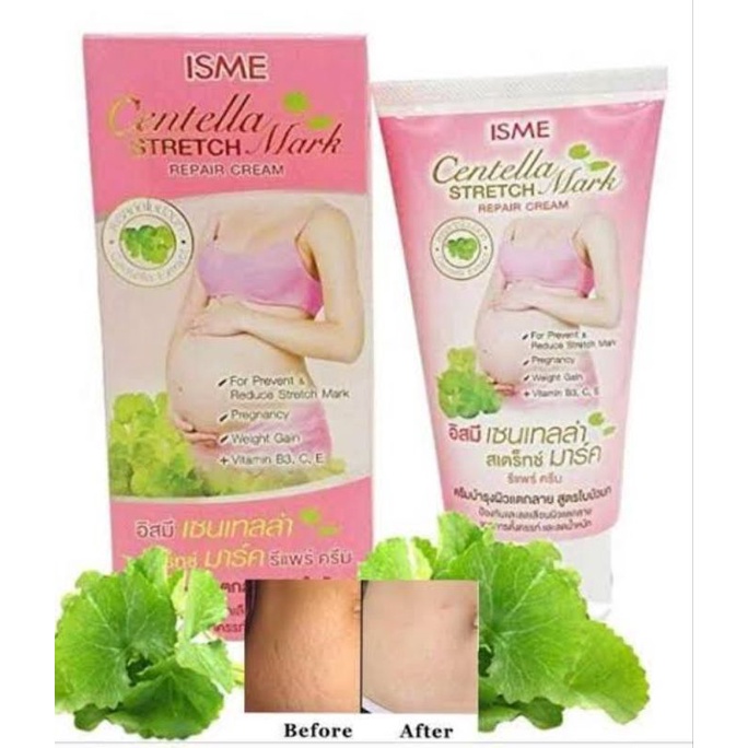 ISME Centella Stretch Mark Repair Cream Penghilang StretchMark Original