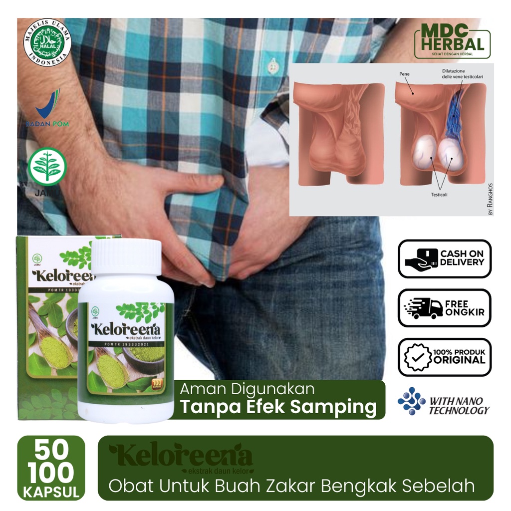 Obat Untuk Buah Zakar Bengkak Sebelah Kanan/Kiri, Obat Buah Zakar Sakit, Obat Buah Zakar Besar Sebel