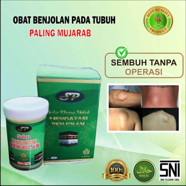 ( TERLARIS ) SALEP KHUSUS BENJOLAN AR-RAIHAN - MENGOBATI BENJOLAN - GONDOK - TUMOR - obat kista - benjolan kista - Qahira - salep benjolan lipoma - salep untuk mengatasi benjolan lipoma - salep terbaik - saleb khusus benjolan - qahira - tiroid