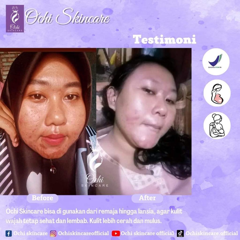 OCHI skincare PLATINUM original paket perawatan premium bpom pemutih wajah aman/SKINCARE WANITA AMAN BPOM