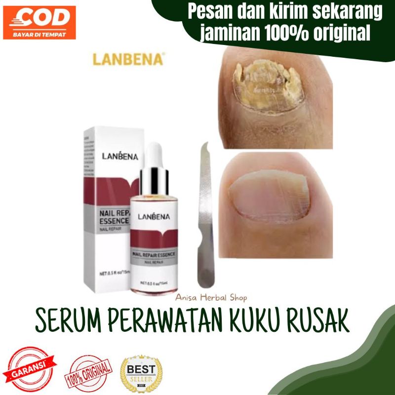 Jual Lanbena Nail Repair Essence Oil Serum Nail Treatment untuk atasi