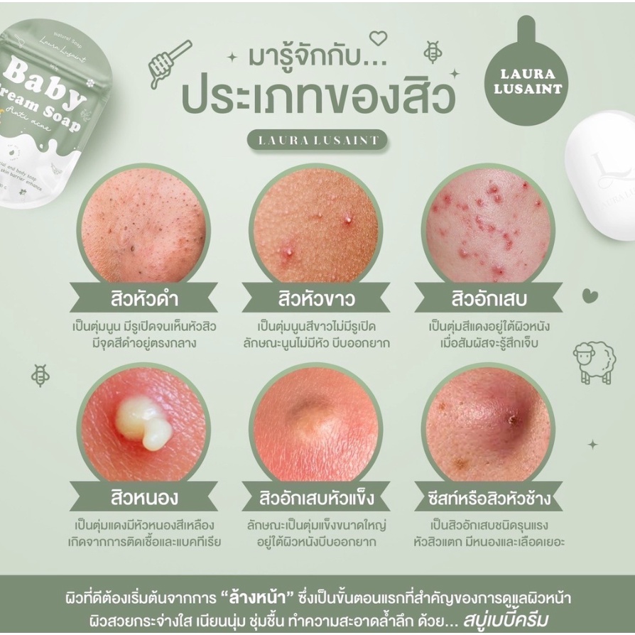 BABY CREAM SOAP ANTI ACNE / SABUN ANTI JERAWAT / ANTI ACNE SOAP