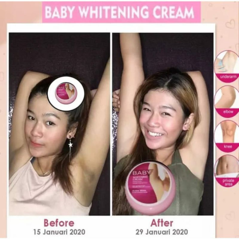 Cream Lipatan Ampuh Memutihkan - Cream Lipatan yg Ampuh - Cream Lipatan Bumil - Cream Lipatan Ketiak Gelap Selangkangan