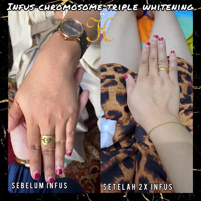 INFUS Chromosome Extra Whitening BOOSTER‼️