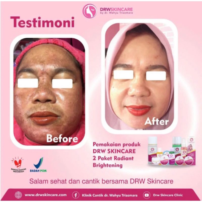 PAKET HEMAT RADIANT BRIGHTENING/UNTUK FLEK HITAM DRW SKINCARE 100% ORIGINAL skincare
