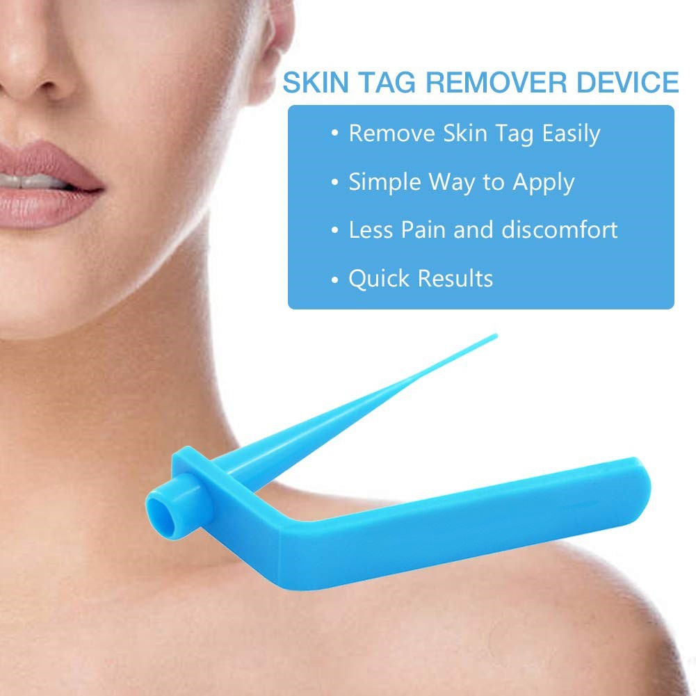 Skin Tag Remover Wart Remover Wart Removal High Quality Tools Kit 1Set