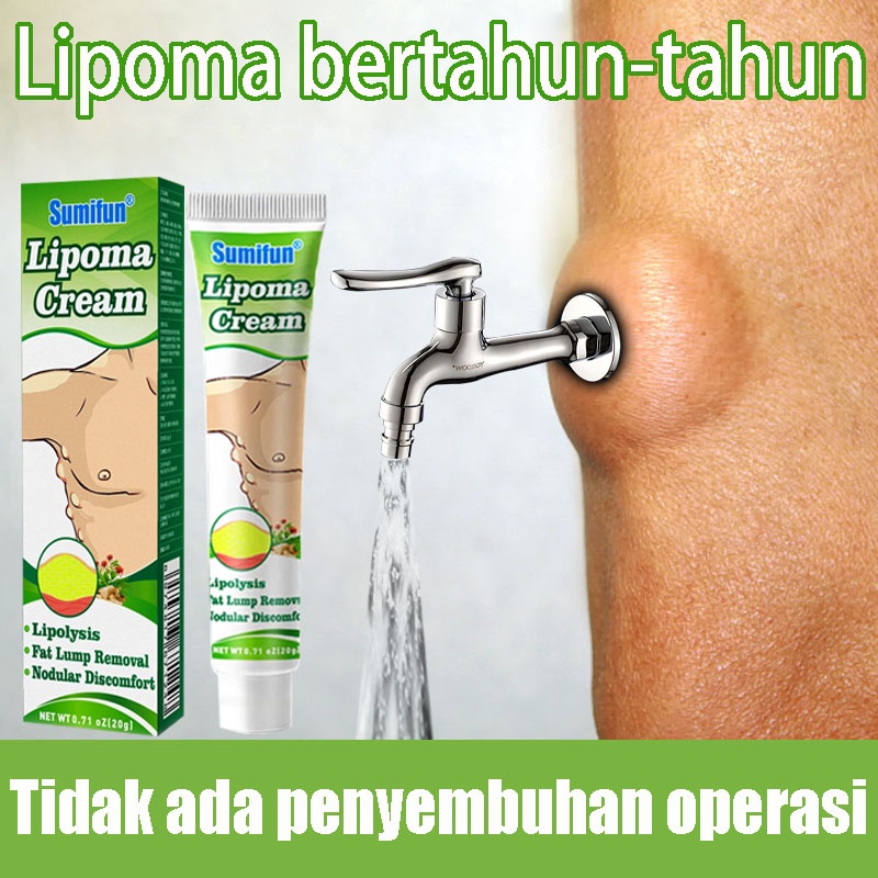 OBAT OLES PENGHILANG BENJOLAN LIPOMA Krim lipoma Obat Benjolan Lipoma 30g Perawatan punggung/leher/paha Kanker Tumor Kelenjar Tiroid Lipoma