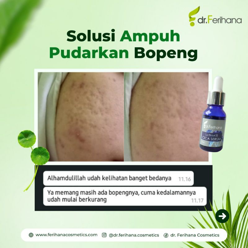 Dr. Ferihana Ultimate Cica Serum Mencerahkan &amp; Menghilangkan Bekas Jerawat, Bopeng, Strechmark &amp; Keriput Skincare Kecantikan BPOM