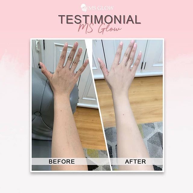 Easy Bright Body Serum Series Ms Glow