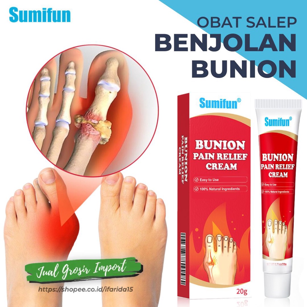 Pereda Nyeri Jari Jempol Kaki Bunion Pain Relief Cream Hallux Valgus