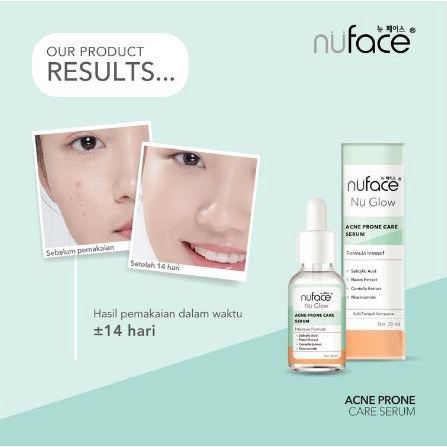 ^ KYRA ^ Nuface Serum Wajah Face Skin Care Vitamin C Acne Prone Care Brighten &amp; Supple Nu Face