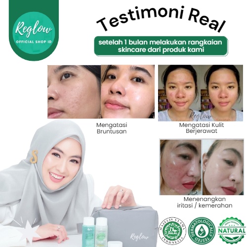 CREAM ACNE Reglow dr Shindy Putri Krim Jerawat Skincare Untuk Kulit Berminyak Berjerawat Dan Bruntusan Pelembab Moisturizer Siang Malam Reg glow Original Official Store