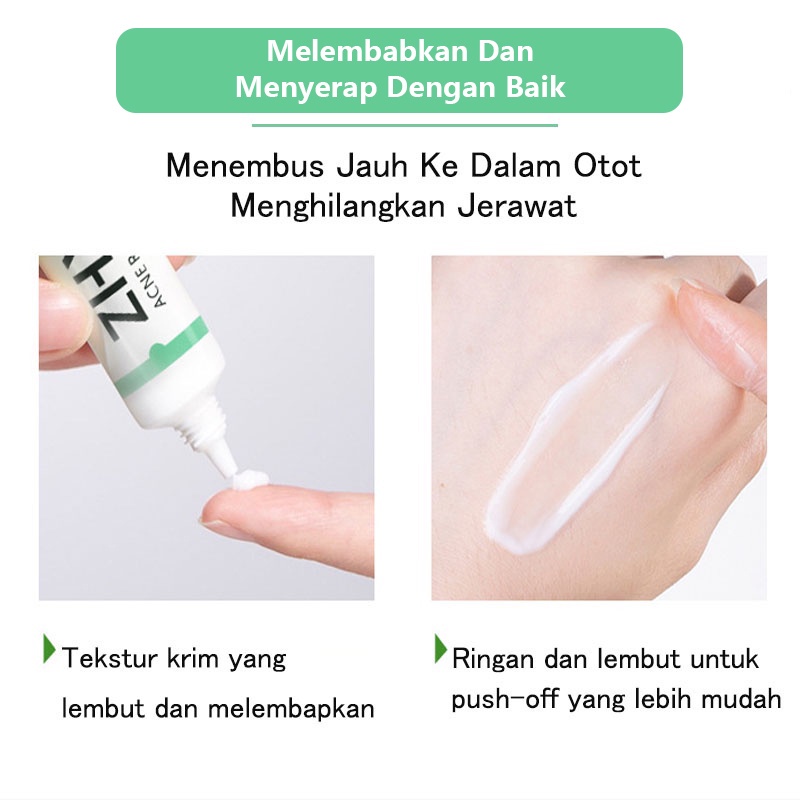 Obat Jerawat Penghilang Bekas Jerawat Bpom Acne Cream Skin Care Salep Jerawat Dan Bekas Jerawat Paling Ampuh