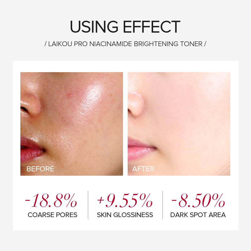 LAIKOU Pro 5% Niacinamide Brightening Toner Mencerahkan Melanin Bintik-bintik 50ml Melembapkan