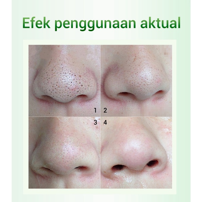 【Ready Stok】  ALLPHV Masker Komedo Penghilang Komedo Blackhead Masker Penghilang Komedo  Untuk Hidung Pore Minimizer